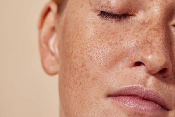 Cropped shot of the face of a young woman with freckles