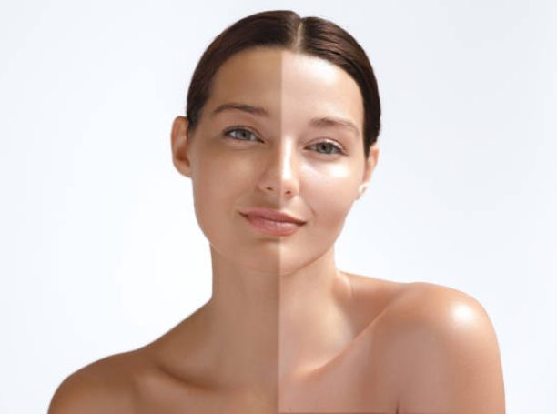 Skin whitening or solarium tanning concept. Asian beauty woman comparison between dark tanned skin and fair pale skin. The multiracial naked model half-face care sun tanning lifestyle. High-quality photo